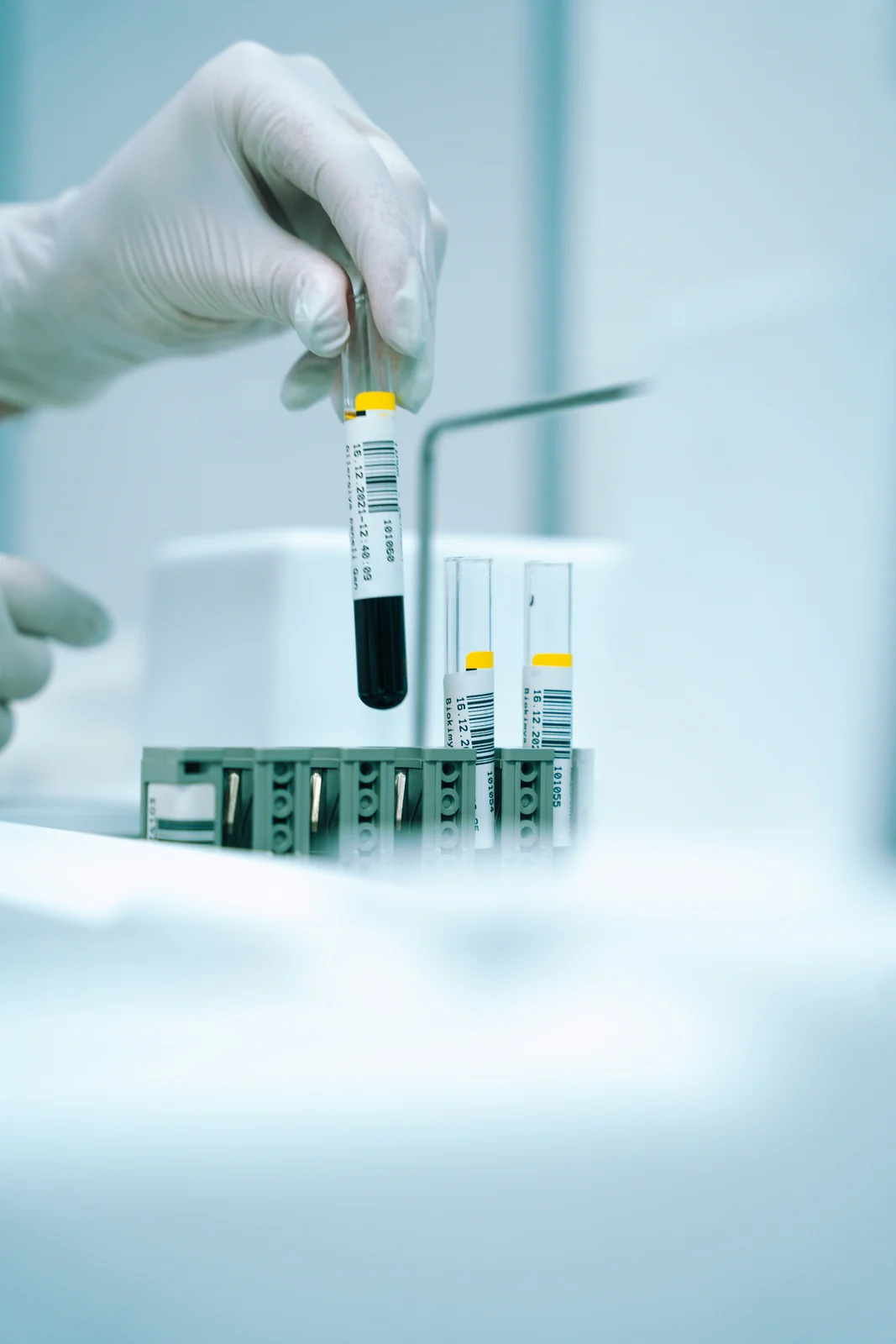 A blood sample prepared for a laboratory panel
